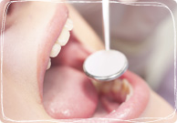 ④付帯する歯や歯周病の治療 